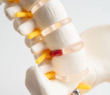 herniated disc treatment orange county ca