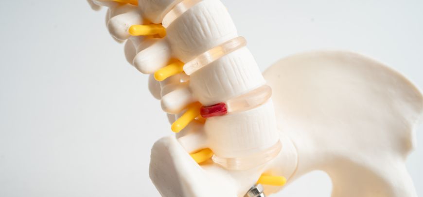 herniated disc treatment orange county ca