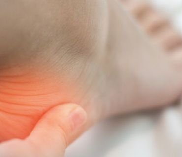 plantar fasciitis orange county ca