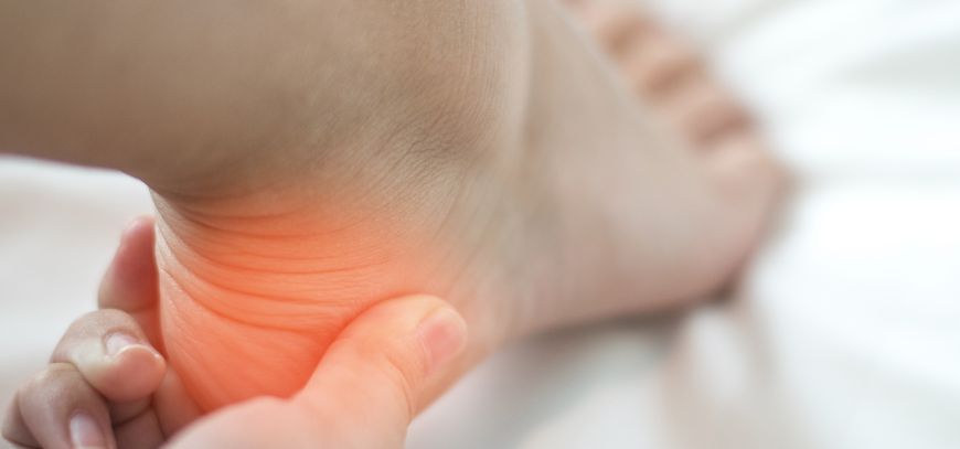 plantar fasciitis orange county ca
