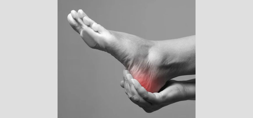plantar fasciitis orange county ca