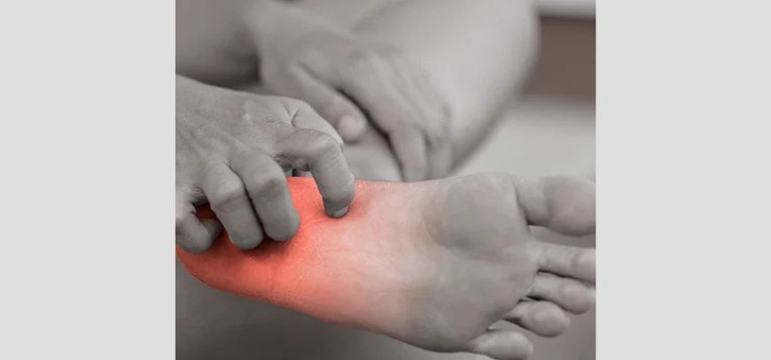 plantar fasciitis orange county ca